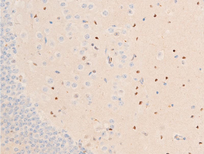 Polyclonal Rabbit anti-Human CHEK1 / CHK1 Antibody (phospho-Ser317, IHC, IF, WB)