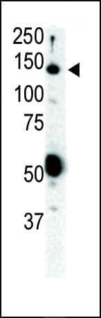 IHC-plus™ Polyclonal Rabbit anti-Human RET Antibody (aa152-182, IHC, WB)