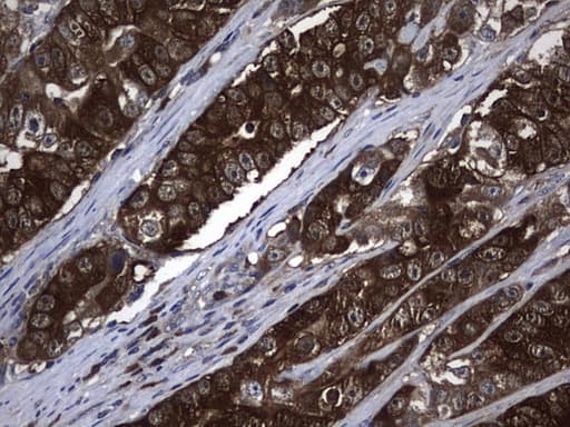 NME1 / NM23 Antibody (clone UMAB92, Carrier-free)