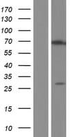 ZNF276 Protein (Over-Expression Lysate Myc-DDK (Flag))