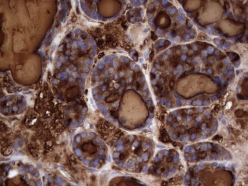 TG / Thyroglobulin Antibody (aa20-358, clone OTI8D4)