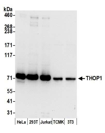 THOP1 / Thimet Oligopeptidase Antibody (aa25-75)