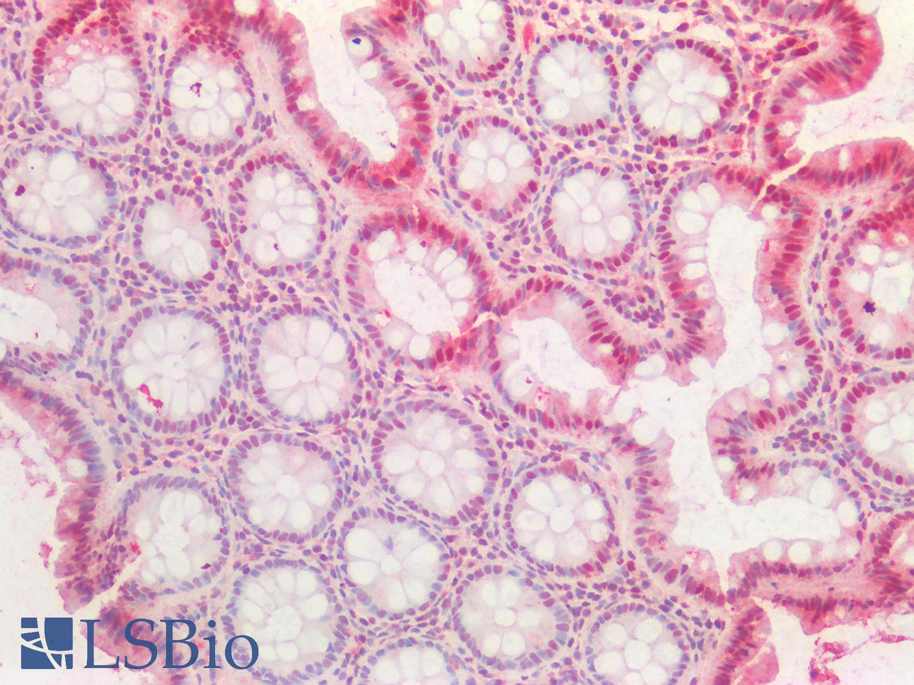 PathPlus™ PCNA Antibody (aa111-122)