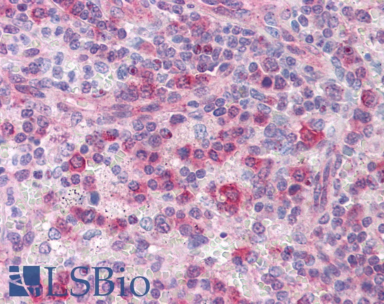 IHC-plus™ ATP5E Antibody (clone 2F3)