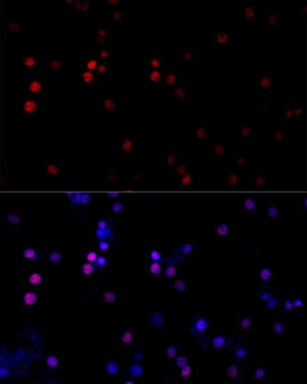 Polyclonal Rabbit anti-Human TBP / GTF2D Antibody (IF)