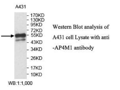 Polyclonal Rabbit anti-Human AP4M1 Antibody (aa285-453, WB)