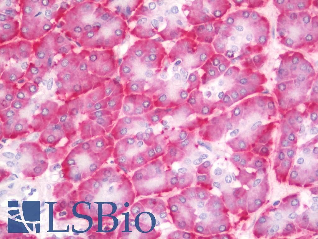 IHC-plus™ Polyclonal Rabbit anti-Human ADGRB3 / BAI3 Antibody (aa211-260, IHC, IF)