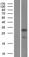 SSX5 Protein (Over-Expression Lysate Myc-DDK (Flag))
