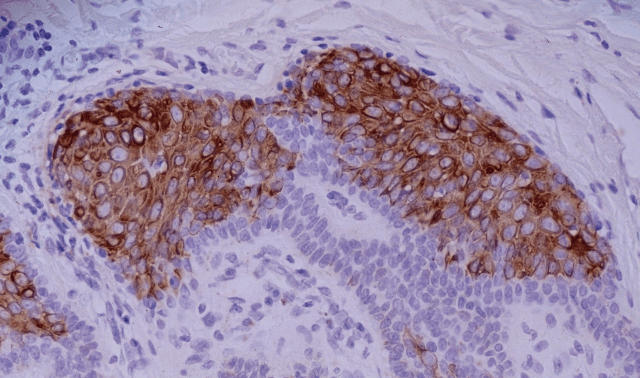 KRT10 / CK10 / Cytokeratin 10 Antibody (clone VIK-10)