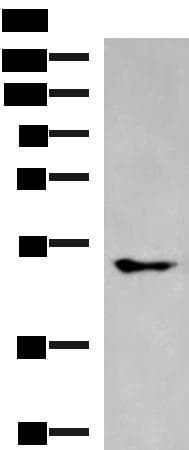 KCNJ2 / Kir2.1 Antibody