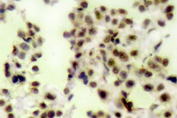 Polyclonal Rabbit anti-Human TP73 / p73 Antibody (phospho-Tyr99, IHC, WB)