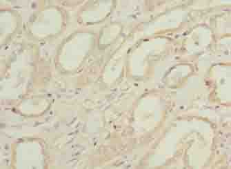 PILRB Antibody