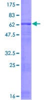 Human TUBD1 / Tubulin Delta Protein (Recombinant GST)
