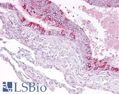 IHC-plus™ CYP1B1 Antibody