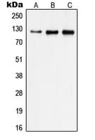Polyclonal Rabbit anti-Human FAK / Focal Adhesion Kinase Antibody (Internal, IHC, IF, WB)