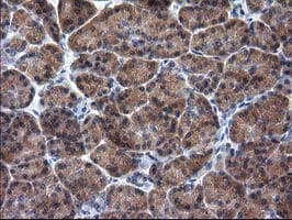 RASSF1 / RASSF1A Antibody (clone OTI2B11)