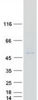 Human VSIG8 Protein (Recombinant Myc-DDK (Flag))