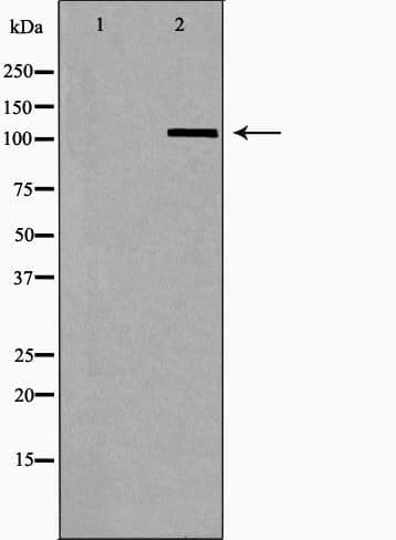 OGT / O-GLCNAC Antibody