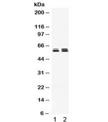 CCT5 / TCP1 Epsilon Antibody