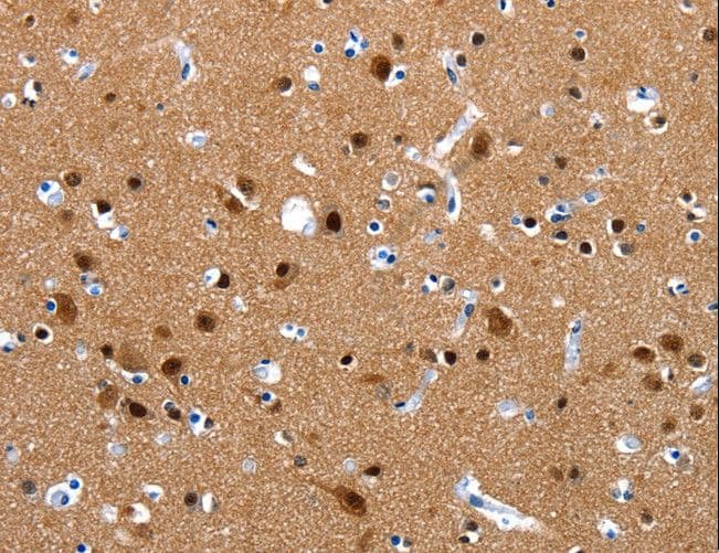 CRMP1 Antibody