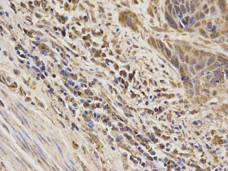 MAPK7 / ERK5 Antibody