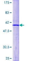 Human CDC34 Protein (Recombinant GST)