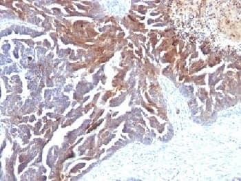 TAG-72 Antibody (clone CC49)