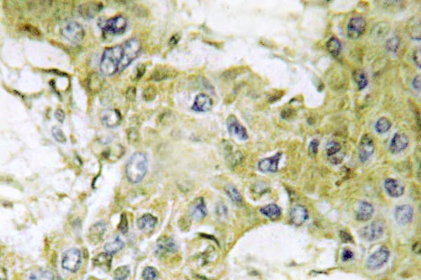 CSNK1G1 / CKI-Gamma 1 Antibody (His3)