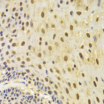 KRT8 / CK8 / Cytokeratin 8 Antibody