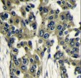 MLST8 / GBL Antibody (aa140-170)