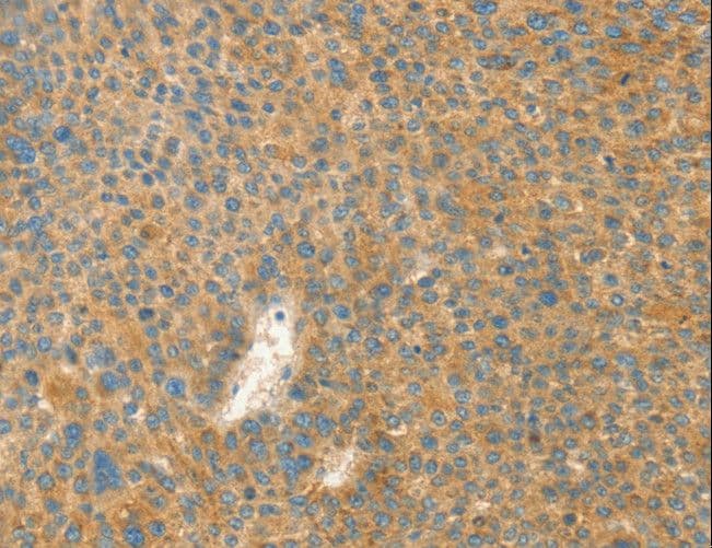 Polyclonal Rabbit anti-Human AANAT Antibody (IHC)