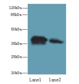CCDC42 Antibody (Coiled-coil domain)