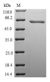 Mouse WNT8B / Wnt 8b Protein (Recombinant 10His-SUMO, N-terminus + Myc, C-terminus)