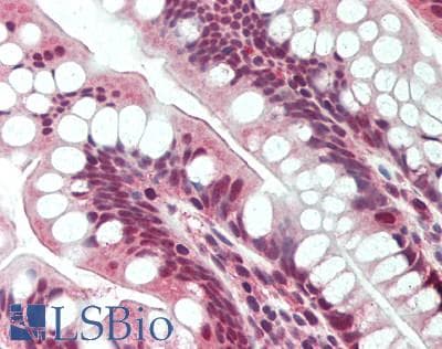IHC-plus™ SMAD5 Antibody (C-Terminus, clone 4B10-B10-B6)