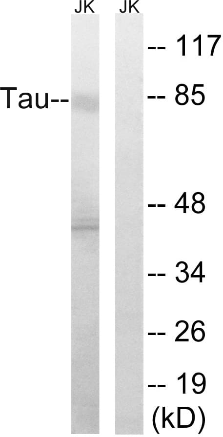 MAPT / Tau Antibody (aa266-315)