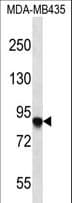 AFAP1 / AFAP Antibody (aa543-572)