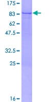 Human ZMYND11 / BS69 Protein (Recombinant GST)