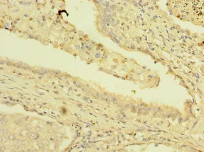Polyclonal Rabbit anti-Human PSMD7 / MOV34 Antibody (IHC, WB)
