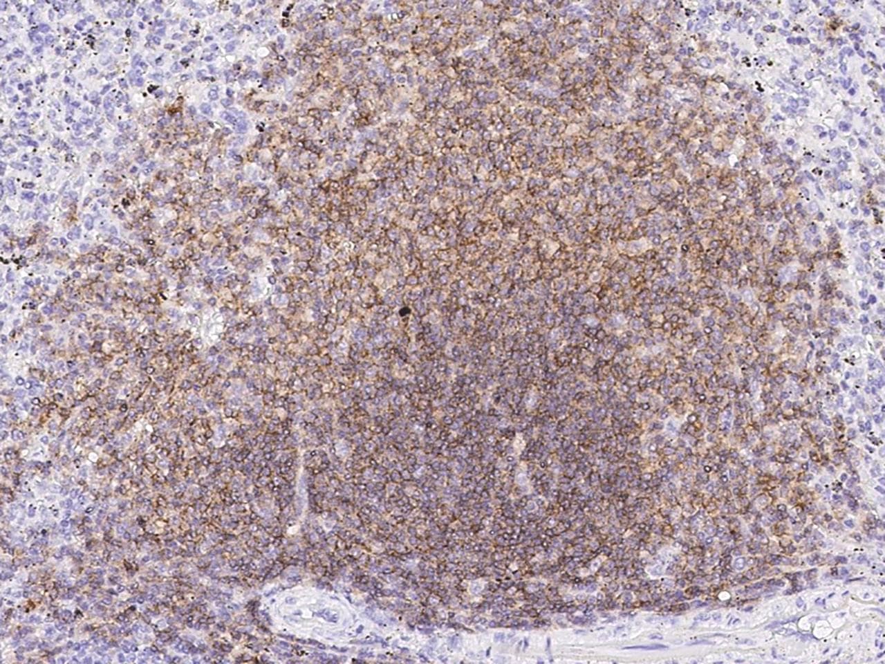CD19 Antibody (aa1-291, clone 25, Preservative Free)