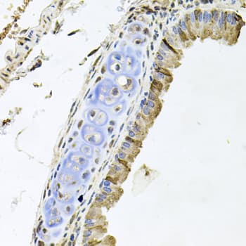 ERBB4 / HER4 Antibody