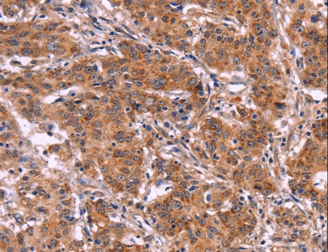 MMP14 Antibody