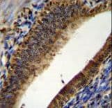 Polyclonal Rabbit anti-Human PTMA / Prothymosin Alpha Antibody (aa1-31, IHC, WB)