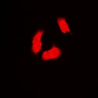 PSMB9 Antibody