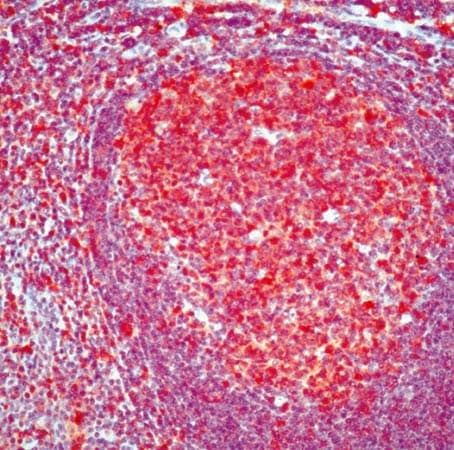 CASP3 / Caspase 3 Antibody