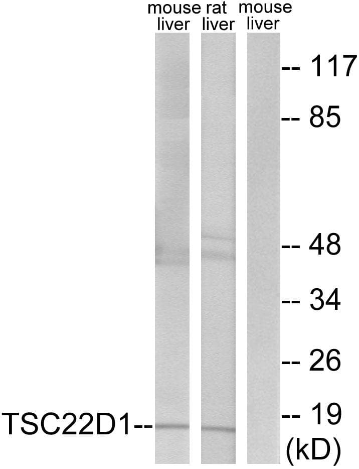 TSC22D1 / TSC22 Antibody