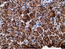 EPHX2 / Epoxide Hydrolase 2 Antibody (clone OTI1H5)