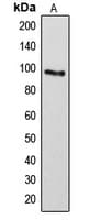 ARHGAP17 / NADRIN Antibody (Internal)