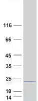 Human MRPL17 Protein (Recombinant Myc-DDK (Flag))