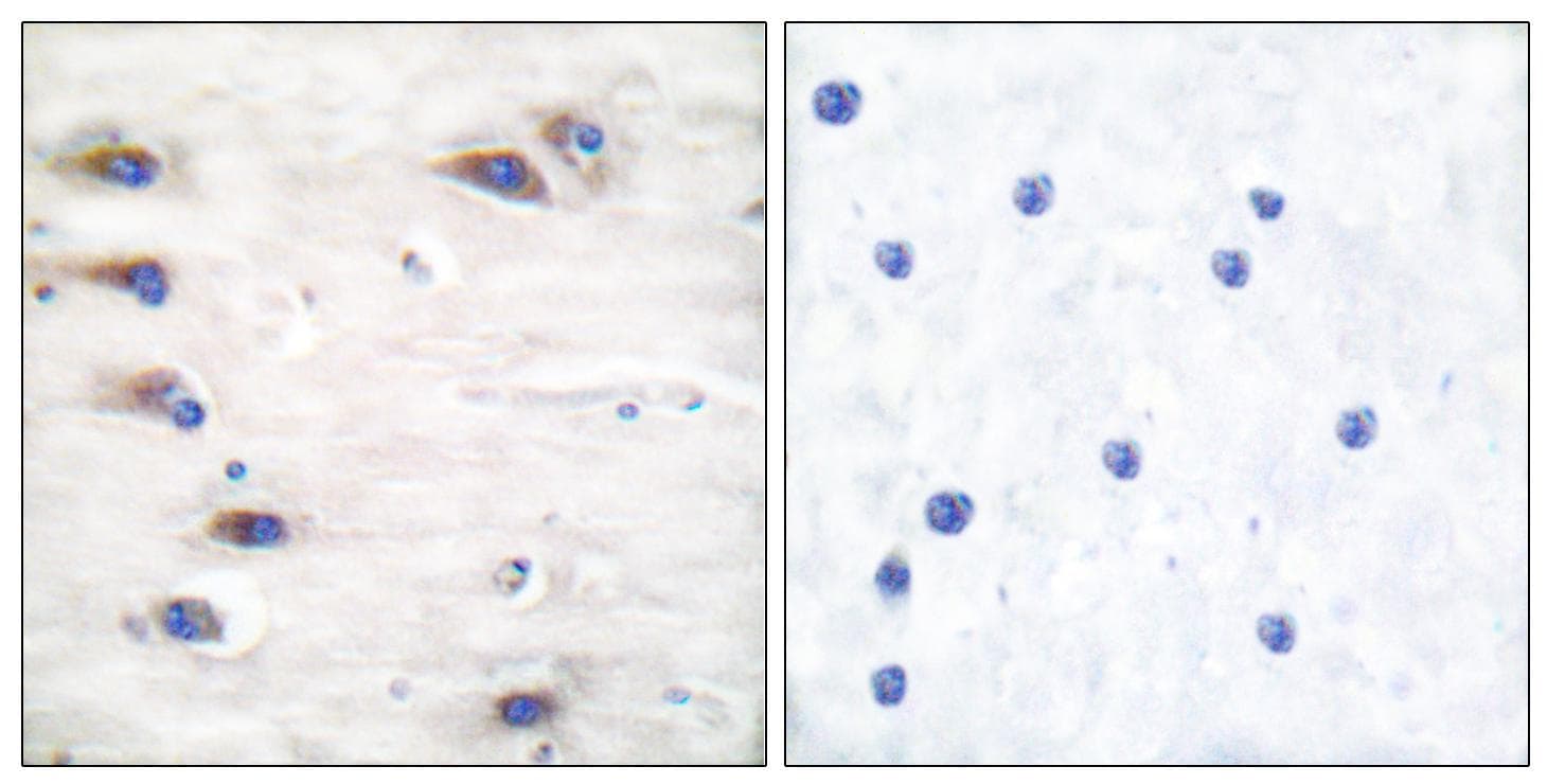 KSR1 Antibody (phospho-Ser392)