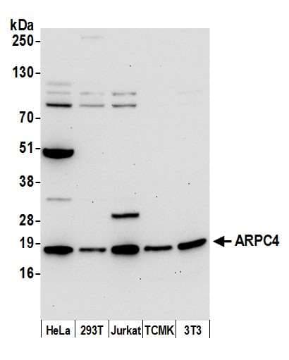 ARPC4 Antibody (aa1-50)